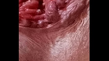 My a****** close upl