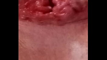 My a****** close upl