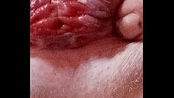 My a****** close upl