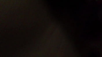 Jade got all chafed after playing too much with her toys