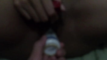 Jade got all chafed after playing too much with her toys