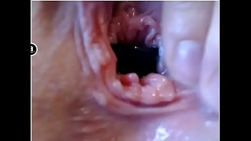 20170420 153957 thumbnail