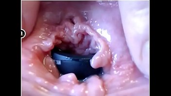 20170420 153957 thumbnail