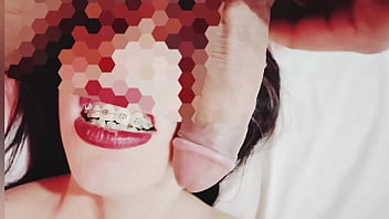 Flaca le provocan dolor anal