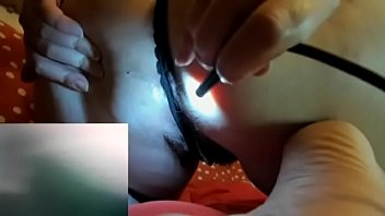 Fartsendoscopeassholehairy 20 4