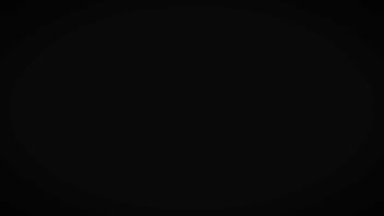 Escena del día fernanda garay y su autentico y unico vitíligo viene por su casting ¿cómo crees que el vitíligo de f