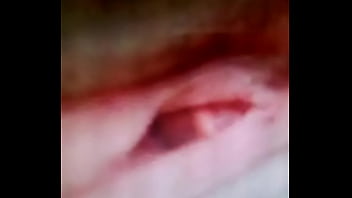 L hermosa kinesiología