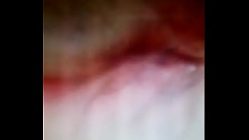 L hermosa kinesiología