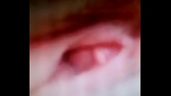 L hermosa kinesiología