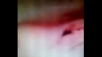 L hermosa kinesiología