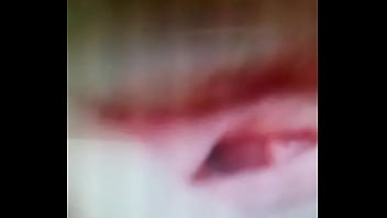 L hermosa kinesiología