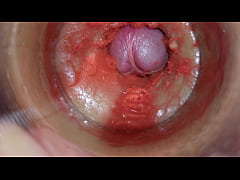 Play MP4 - Camera Inside Deep Pussy Captures Huge Ejaculation of Sperm 4k