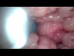 Play MP4 - Endoscope camera shows the most sensitive parts of the penis Educational video