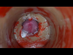 Play MP4 - Insemination - Internal Camera Captures Deep Male Ejaculation