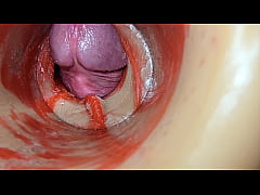 Play MP4 - Female Insemination - Internal Camera Captures Deep Male Huge Ejaculation