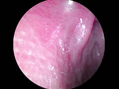 Play MP4 - Camera deep inside of the wet pussy and captured the intense female orgasm&excl;&excl;