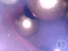 Play MP4 - CAM INSIDE ASS&colon; Ball Chain disappears deep in her hole