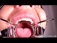 Play MP4 - Inside Jen Capone's Mouth