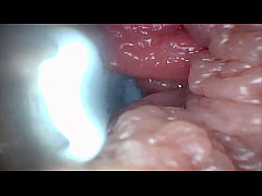 Play MP4 - Visual Guide to G-Spot Stimulation and Orgasm &mdash; Endoscop Perspective