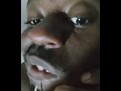 Play MP4 - Privately showing other ways that I pop pimples for free whenever they develop 2