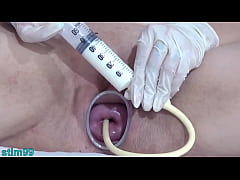 Play MP4 - German Cervix Stretching with Catheter Inflation Uterus