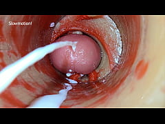 Play MP4 - Camera Inside Deep Pussy Captures Dose Ejaculation of Sperm ASMR