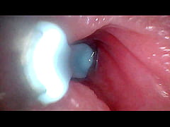 Play MP4 - I couldn&rsquo;t believe what happens INSIDE the penis as sperm passes through &lpar;endoscopic footage&rpar;