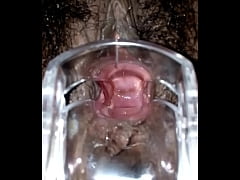 Play MP4 - SLIM INDIAN BROWN GIRL CERVIX SPECULUM CHECK VAGINAL OPENING