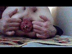 Play MP4 - Anal prolapse