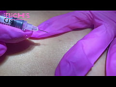 Play MP4 - Extra&ccedil;&atilde;o de cravos e espinhas