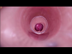 Play MP4 - Female Insemination - Internal Camera Captures Deep Male Ejaculation