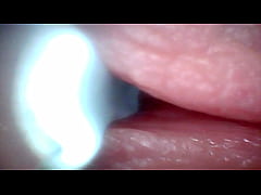 Play MP4 - Endoscope camera captures moment of male ejaculation
