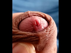 Play MP4 - Mel de pica