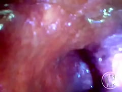 Play MP4 - POV Extreme Deep Anal Exploration&excl; Fast visible Heartbeat