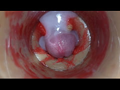 Play MP4 - Camera Inside Deep Pussy Captures Very Huge Ejaculation of Sperm ASMR