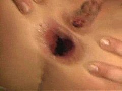 Play MP4 - Anal gape 2
