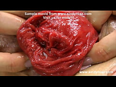 Play MP4 - Sindy Rose fuck her ass with a big white dong & prolapse