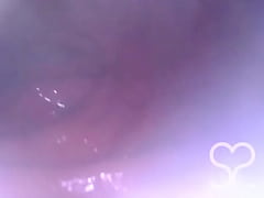 Play MP4 - Anal Endoscope all the way in my Transverse Colon&excl;